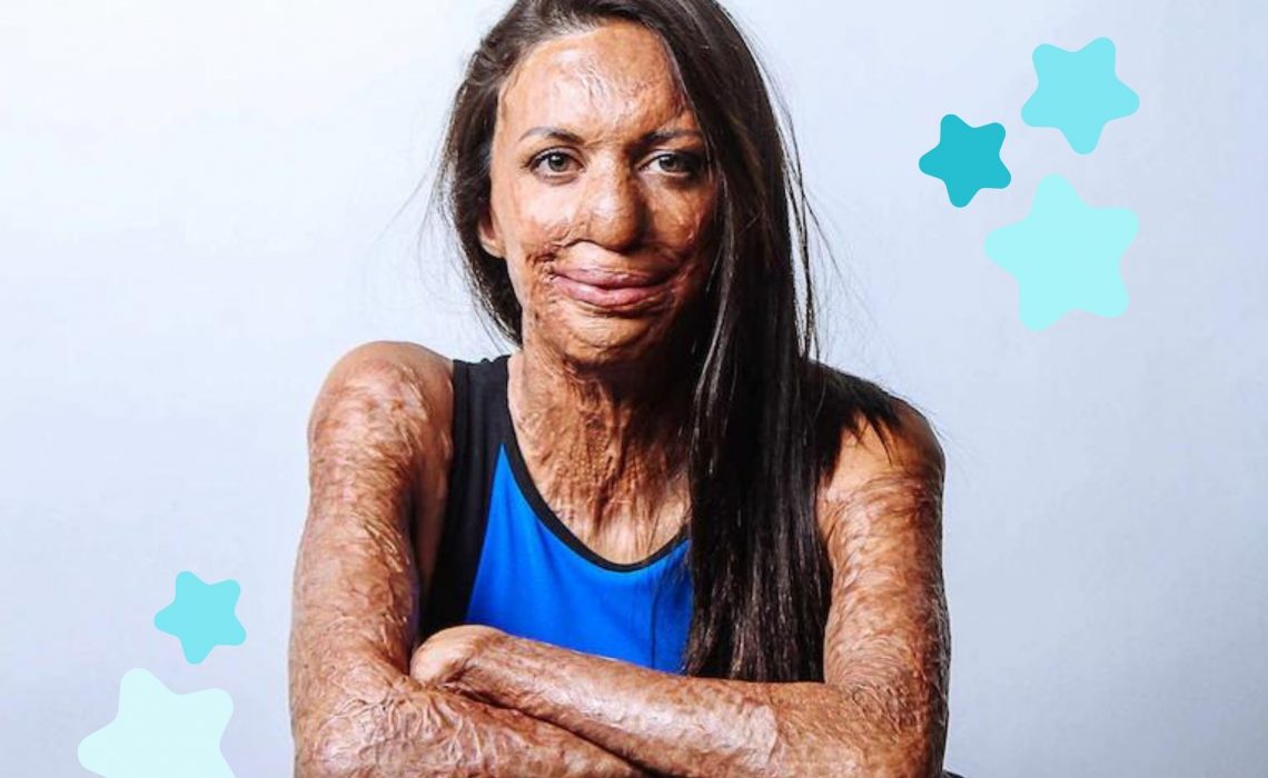 Turia Pitt smiling