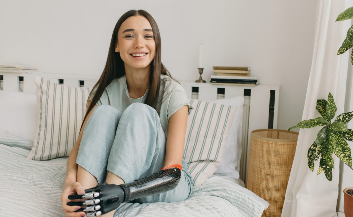 Laughing gorgeous European young lady sitting on bed with legs in her hands, having bionic prosthetic arm, long beautiful brown hair, wearing casual clothes, resting at home in bedroom